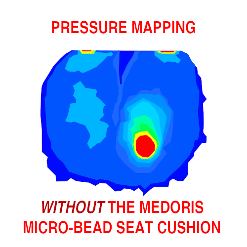 Positioning and Pressure Care: 9-Chamber Support Cushion - M100 - MEDORIS